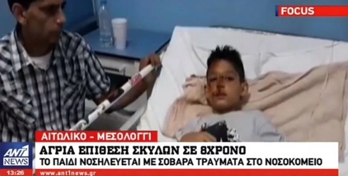 Σοκάρει η περιγραφή του 8χρονου – Δέχτηκε άγρια επίθεση από σκυλιά (βίντεο)